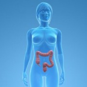 Colon Cancer related image